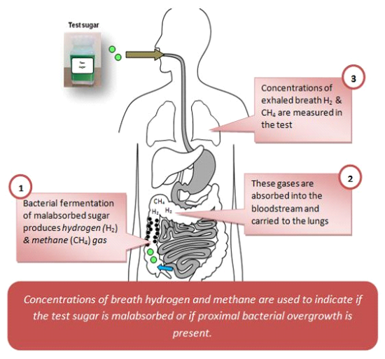 hydrogen-breath-test